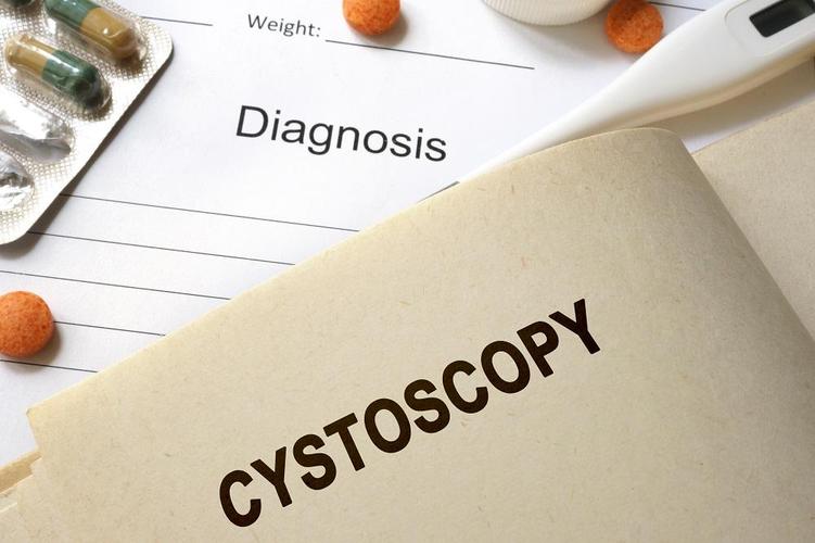 Things to expect before going into a cystoscopy procedure
